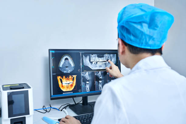 Best Emergency Dental Care for Abscessed Tooth in North Bethesda, MD