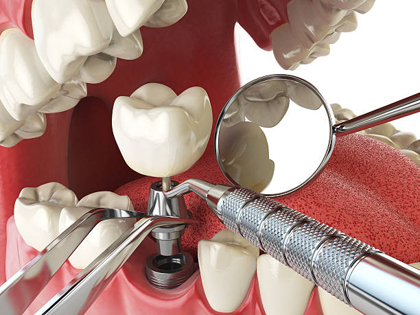 Best 24-Hour Emergency Dentist in North Bethesda, MD