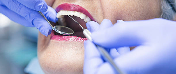 Best Broken or Cracked Tooth Emergency Dentist in North Bethesda, MD